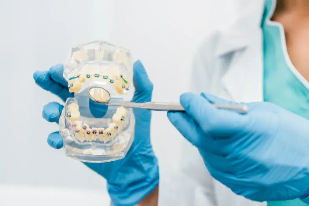 Orthodontie invisible, retrouver un sourire harmonieux en toute discrétion