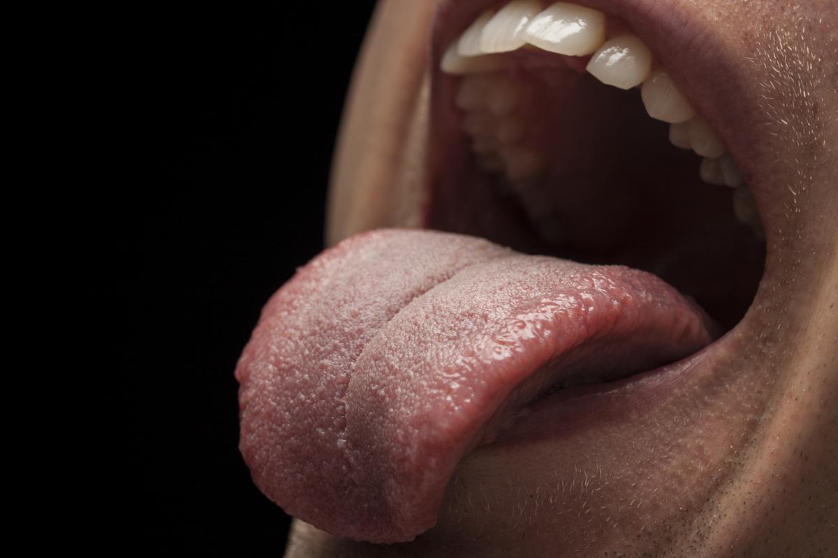 bouton sur la langue remède naturel