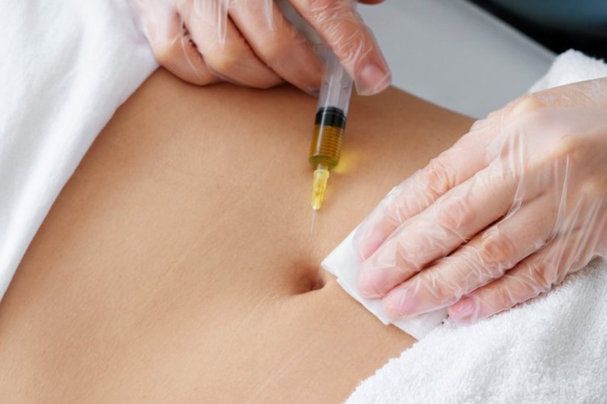 cryolipolyse-dangers-efficacite