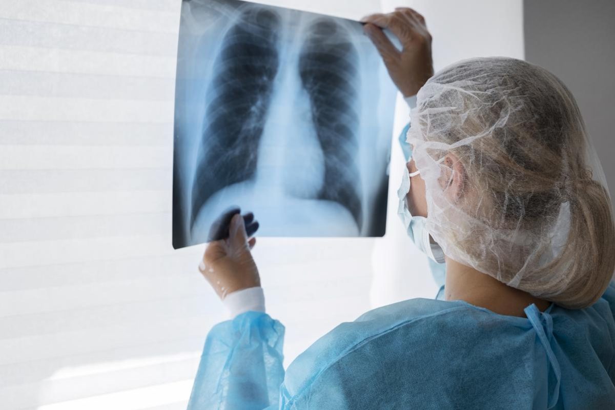 j'ai guéri d'un cancer du poumon métastasé