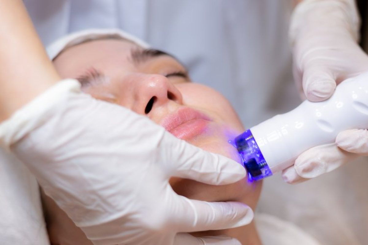 laser-co2-cicatrices-douleur-solutions